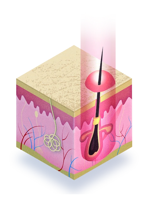 Neo laser energy diagram