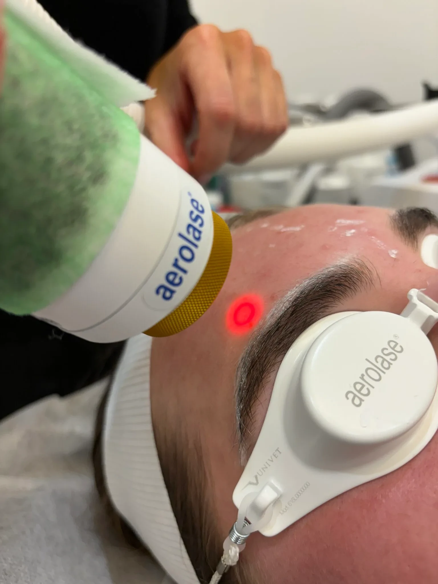 Aerolase Neo Elite treatment in progress on a patient