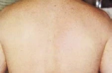 Unwanted Hair