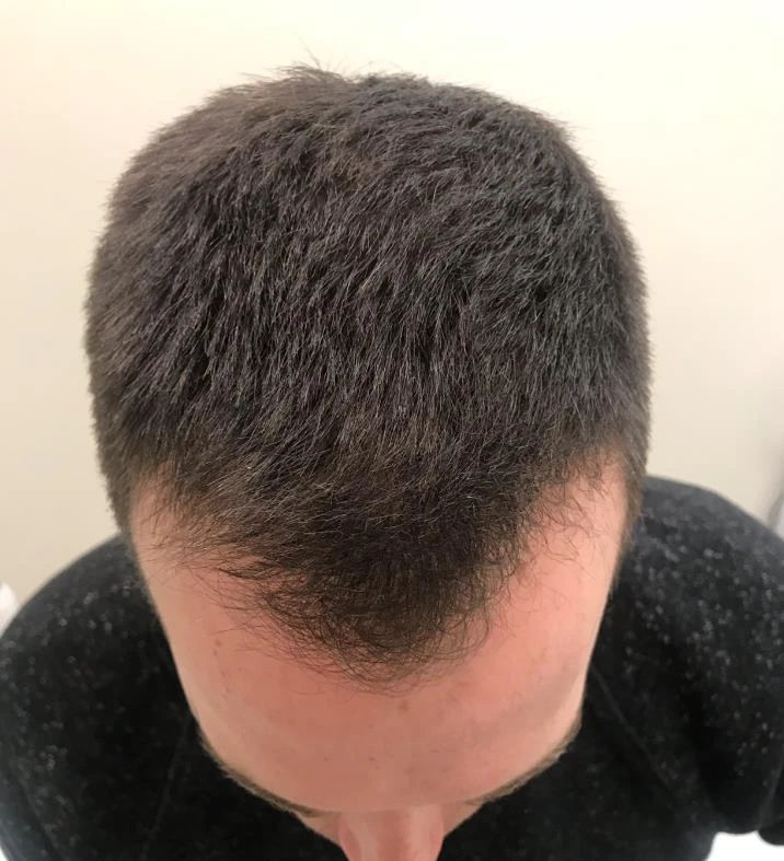 Dry Skin & Texture results