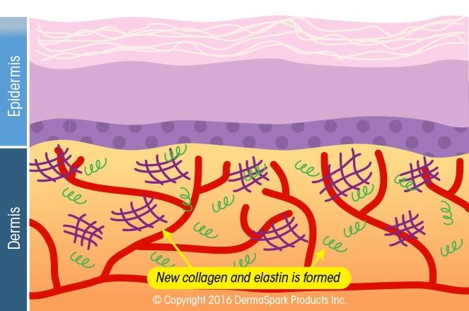 Rejuvenated skin diagram